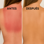 GEL HIDRATANTE CON EXTRACTO DE ALOE VERA